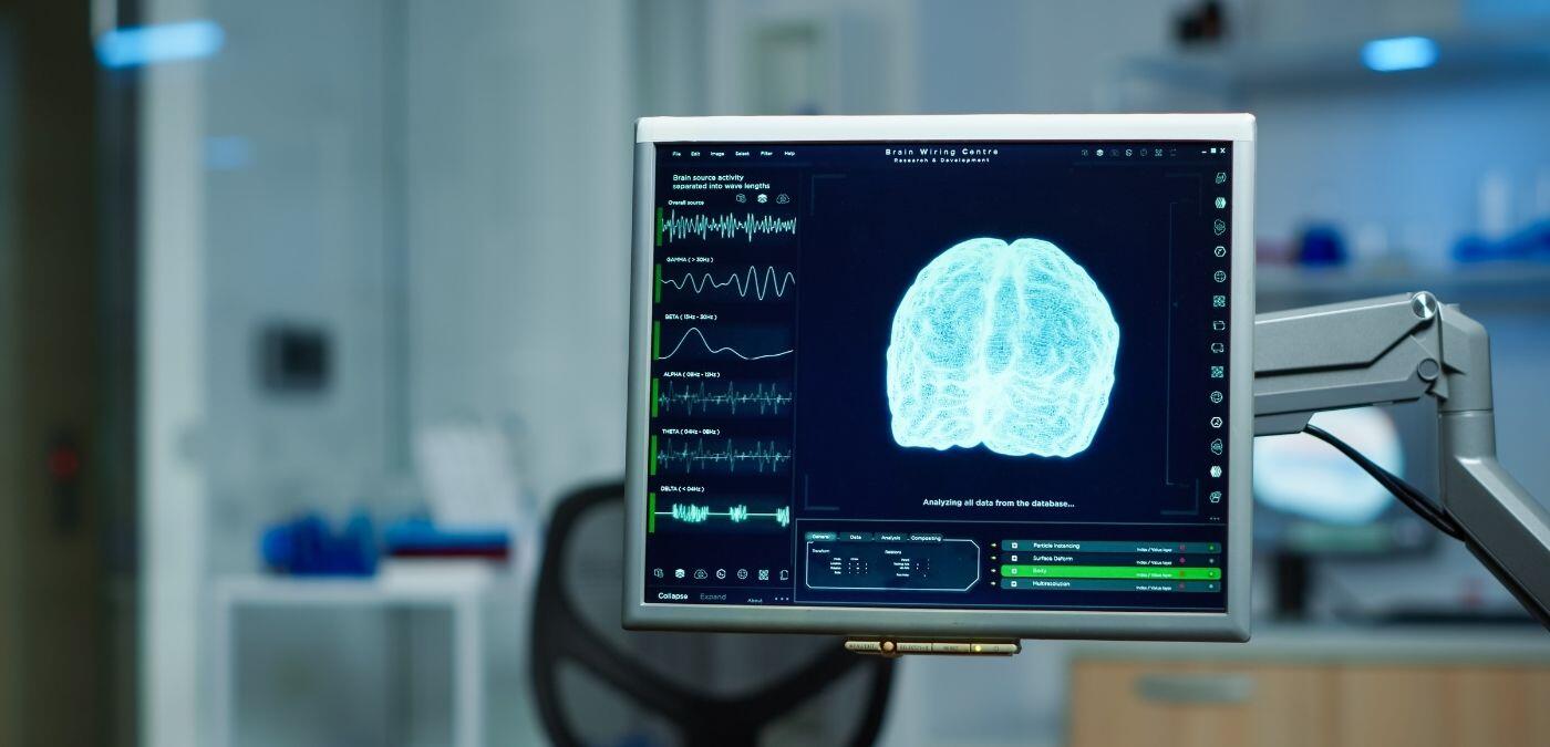 Neuropsicología en las empresas